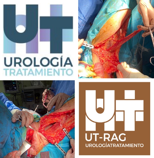 Unidad de Cirugía reconstructiva del área genital UT